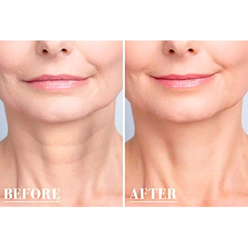 Reusable Anti Wrinkle Chest Anti Spier