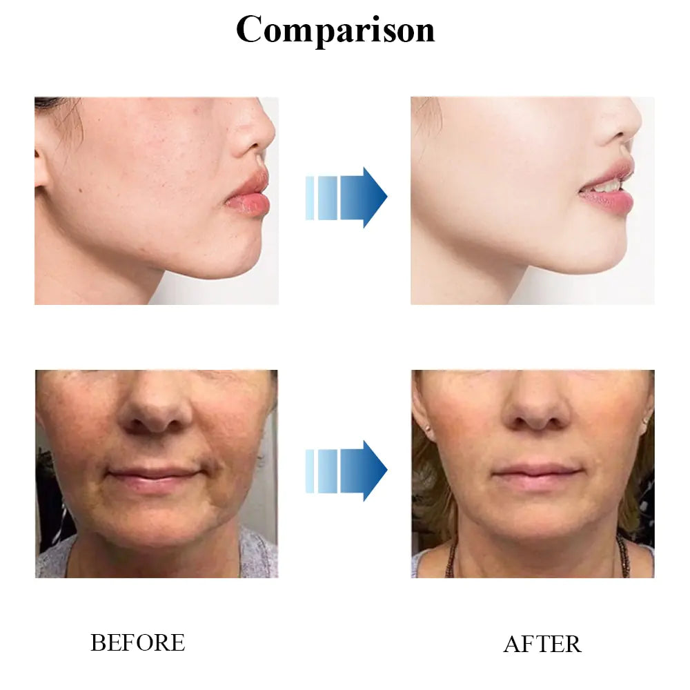 Anti Aging Face Cream Anti Spier