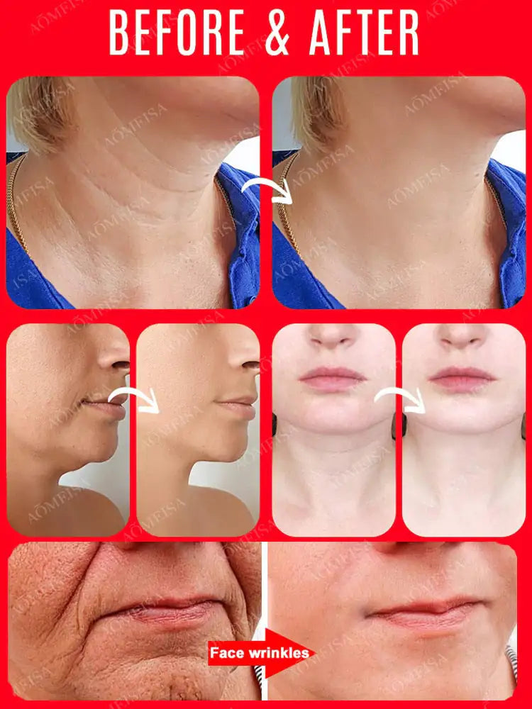 Eelhoe™ Anti-wrinkle anti-aging essence firming skin facial Anti Spier