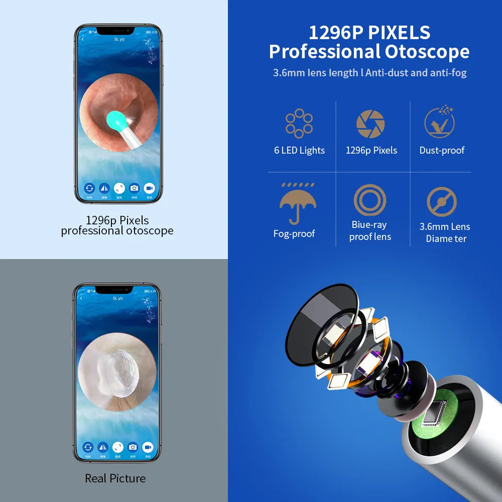 Ear Wax Removal Tool With Camera Anti Spier